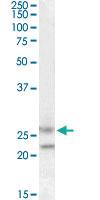 Anti-FBXO44 Goat Polyclonal Antibody