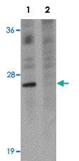 Anti-TSPAN9 Rabbit Polyclonal Antibody