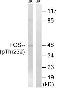 Western blot analysis of lysates from Jurkat cells treated with EGF 200ng/ml 5' using Anti-FOS (phospho Thr232) Antibody. The right hand lane represents a negative control, where the antibody is blocked by the immunising peptide