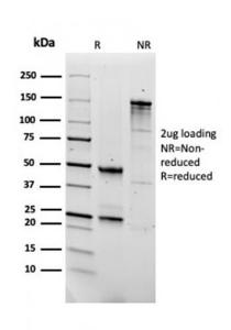 SDS-PAGE analysis of Anti-Fibronectin Antibody [FN1/2950] under non-reduced and reduced conditions; showing intact IgG and intact heavy and light chains, respectively. SDS-PAGE analysis confirms the integrity and purity of the antibody