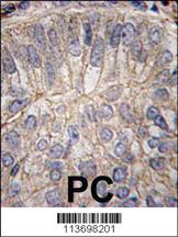 Anti-CDH3 Rabbit Polyclonal Antibody