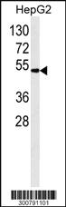 Anti-ALDH2 Mouse Monoclonal Antibody