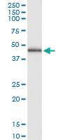 Anti-MVK Rabbit Polyclonal Antibody