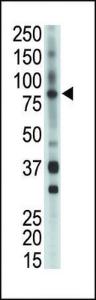 Anti-BMX Rabbit Polyclonal Antibody (AP (Alkaline Phosphatase))