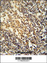 Anti-TNFAIP2 Rabbit Polyclonal Antibody