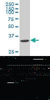 Anti-ABHD10 Mouse Polyclonal Antibody