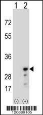 Anti-PRDX3 Rabbit Polyclonal Antibody