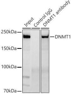 Immunoprecipitation analysis of 300 µg extracts of Jurkat cells using 3 µg of Anti-Dnmt1 Antibody [ARC51348] (A307587) This Western blot was performed on the immunoprecipitate using Anti-Dnmt1 Antibody [ARC51348] (A307587) at a dilution of 1:1000