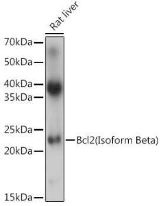 Western blot analysis of extracts of Rat liver, using Anti-Bcl-2 Antibody (A305870) at 1:1,000 dilution