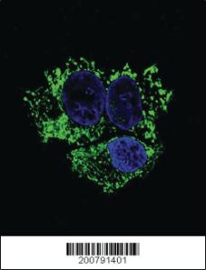 Anti-ALDH2 Mouse Monoclonal Antibody