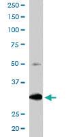 Anti-FBXW2 Goat Polyclonal Antibody