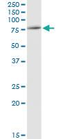 Anti-RUVBL2 Polyclonal Antibody Pair