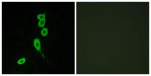 Anti-MSHR antibody