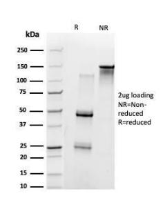 SDS-PAGE analysis of Anti-UBE3A Antibody [PCRP-UBE3A-1A2] under non-reduced and reduced conditions; showing intact IgG and intact heavy and light chains, respectively. SDS-PAGE analysis confirms the integrity and purity of the Antibody