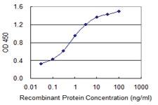 Anti-CRYGC Mouse Monoclonal Antibody [clone: 7C4]