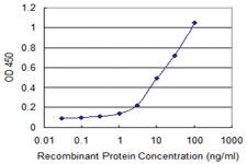 Anti-HLA-DQA1 Mouse Monoclonal Antibody [clone: 1A3]