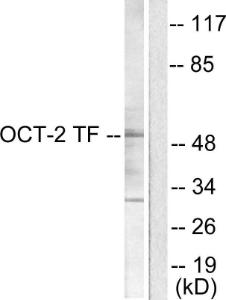 Western blot analysis of lysates from COS7 cells using Anti-OCT2 Antibody. The right hand lane represents a negative control, where the antibody is blocked by the immunising peptide.