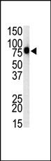 Anti-TLR1 Rabbit Polyclonal Antibody