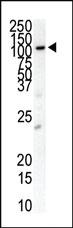 Anti-PDGFRB Rabbit Polyclonal Antibody