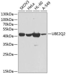 Western blot analysis of extracts of various cell lines, using Anti-UBE2Q2 Antibody (A10857) at 1:1,000 dilution