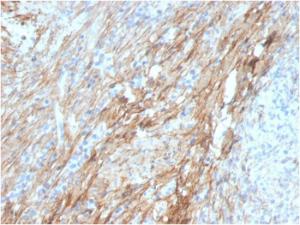 Immunohistochemical analysis of formalin-fixed, paraffin-embedded human lung using Anti-Fibronectin Antibody [FN1/3029]