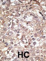 Anti-TLR1 Rabbit Polyclonal Antibody