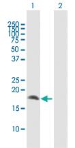 Anti-CRYGD Rabbit Polyclonal Antibody