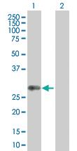 Anti-HLA-DQB1 Mouse Polyclonal Antibody