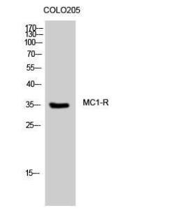 Anti-MSHR antibody