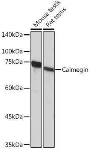 Western blot analysis of extracts of various cell lines, using Anti-Calmegin Antibody [ARC2214] (A305871) at 1:1,000 dilution