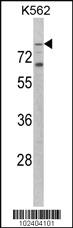 Anti-TLR2 Rabbit Polyclonal Antibody