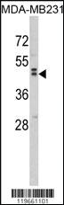 Anti-WNT10B Rabbit Polyclonal Antibody