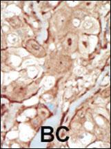 Anti-PDGFRB Rabbit Polyclonal Antibody