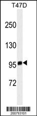 Anti-EZH2 Mouse Monoclonal Antibody