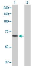 Anti-CHDH Mouse Polyclonal Antibody