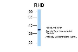 Anti-RHD Rabbit Polyclonal Antibody