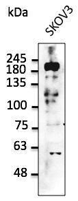 SKOV cell lysate detected with Anti-ERBB2 Antibody at a 1:2,500 dilution. Lysate at 50µg and rabbit anti-goat IgG antibody (HRP) at a 1:10,000 dilution.