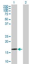 Anti-CRYGD Rabbit Polyclonal Antibody