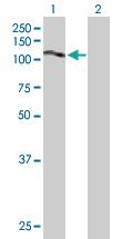 Anti-SLC20A2 Mouse Polyclonal Antibody