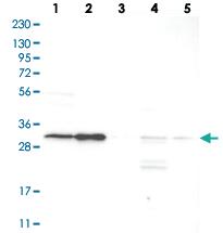 Anti-SLC25A22 Rabbit Polyclonal Antibody