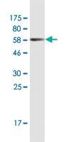 Anti-RNF126 Mouse Monoclonal Antibody [clone: 3F11]