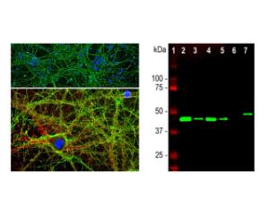 Left: Analysis of GAP43 expression in cortical neuron-glial cell culture from E20 rat by ICC. Staining was performed with chicken antibody to GAP43 (green) and rabbit antibody to alpha-II spectrin (red). Blue: DAPI nuclear stain. Right: Western blot analysis of tissue and cell lysates.