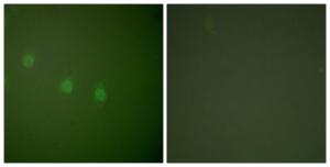 Immunofluorescence analysis of COS7 cells using Anti-OCT2 Antibody. The right hand panel represents a negative control, where the antibody was pre-incubated with the immunising peptide.