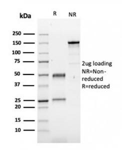 SDS-PAGE analysis of Anti-Fibronectin Antibody [FN1/3029] under non-reduced and reduced conditions; showing intact IgG and intact heavy and light chains, respectively. SDS-PAGE analysis confirms the integrity and purity of the antibody.