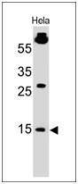 Western blot analysis of HeLa cell lysate using Anti-SUMO-1 Antibody [SM1/495]