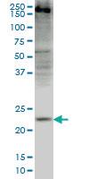 Anti-CRYGD Mouse Monoclonal Antibody [clone: 4E12]