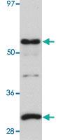 Anti-PKDCC Rabbit Polyclonal Antibody