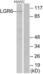 Western blot analysis of lysates from HUVEC cells using Anti-LGR6 Antibody. The right hand lane represents a negative control, where the Antibody is blocked by the immunising peptide