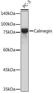 Western blot analysis of extracts of PC-3 cells, using Anti-Calmegin Antibody [ARC2214] (A305871) at 1:1,000 dilution