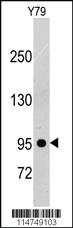 Anti-PDGFRB Rabbit Polyclonal Antibody